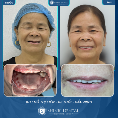 Khách hàng Đỗ Thị Liên